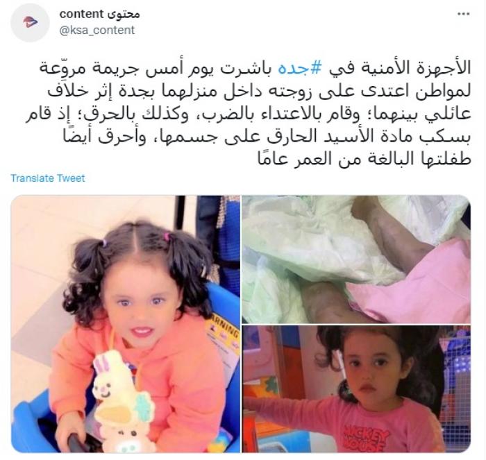جريمة تهز السعودية.. مواطن يحرق زوجته بالأسيد ويشوّه جسد طفلتها