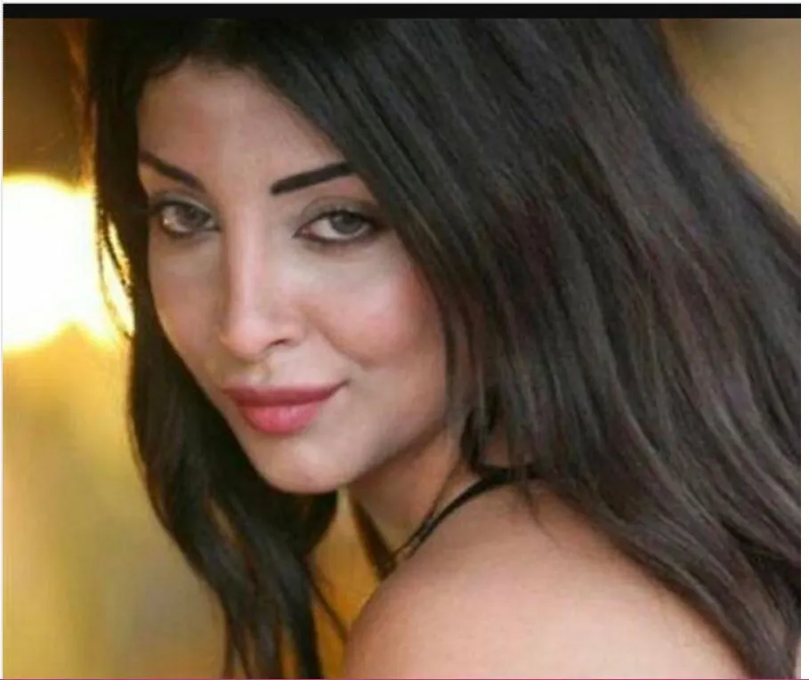 رولا يموت قبل عمليات التجميل